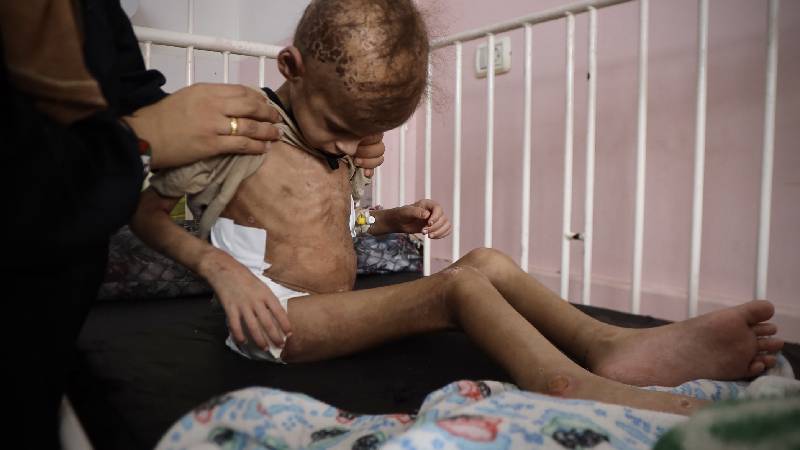 unrwa gazzede 3 yas alti her 3 cocuktan biri son 24 saati yiyeceksiz gecirdi hnvHGIRY